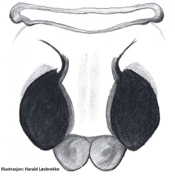 Datei:Haplodrassus signifer Vulva do HLovbrekke.jpg