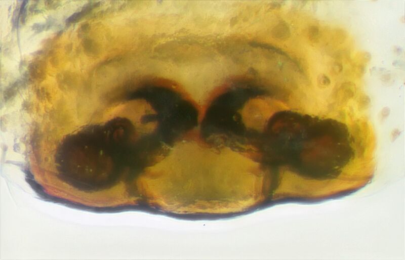 Datei:Gonatium hilare Vulva.jpg