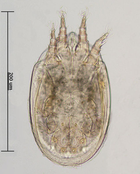 Datei:Sancassania chelone deutonymph A5457 O2245.jpg