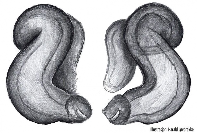Datei:Xysticus ulmi vulva do HLovbrekke.jpg