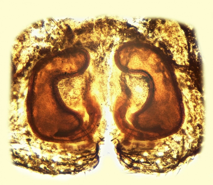 Datei:Micaria rossica Vulva 20160922122323-fbf01569-me.jpg