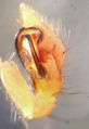 Pedipalpus, lateral