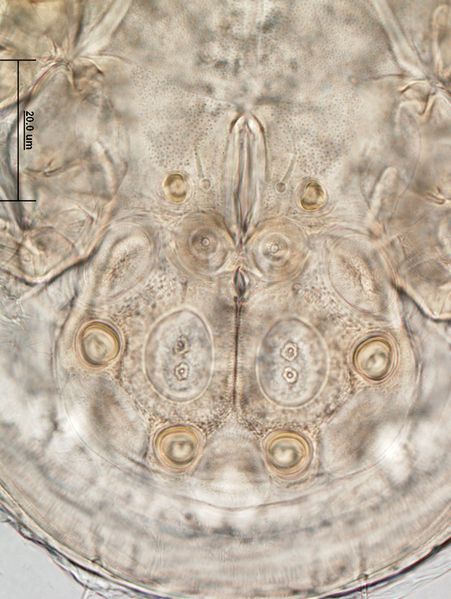 Datei:Sancassania chelone deutonymph A5457 O2305.jpg