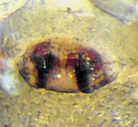 Epigyne