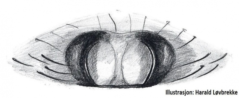 Datei:Hylyphantes graminicola epigyn HLovbrekke.jpg