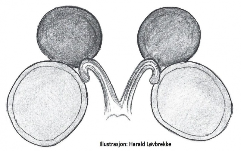 Datei:Lasaeola tristis vulva do HLovbrekke.jpg