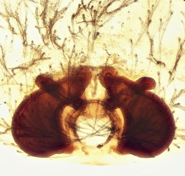 Datei:Cheiracanthium montanum Epigyne 20160628192616-efcb173a-me.jpg