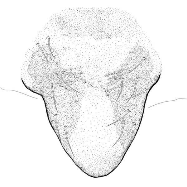 Datei:Tibioplus diversus epigyne.jpg