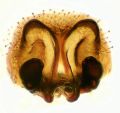 Vulva
