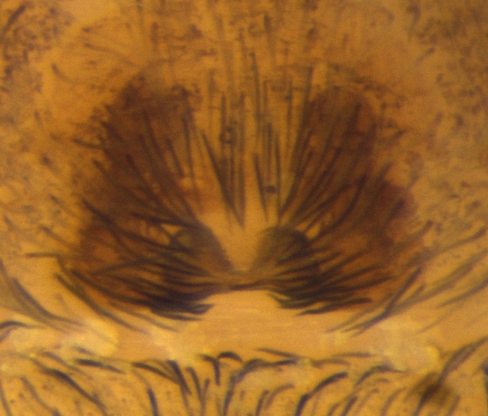 Datei:Calositticus caraicis epigyne 20130908131911-8dc3bf9e-la.jpg