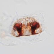 Vulva