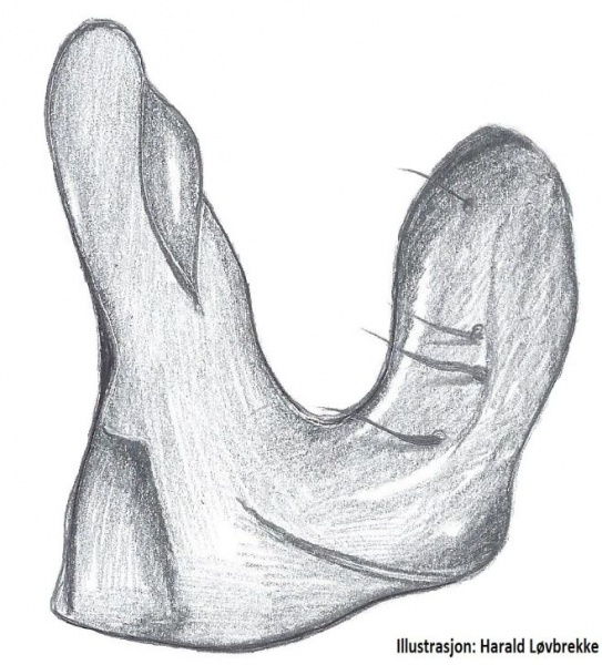 Datei:Agyneta cauta paracymbium HLovbrekke.jpg