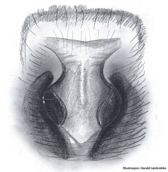 Datei:Haplodrassus signifer epigyn HLovbrekke.jpg