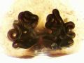 Vulva