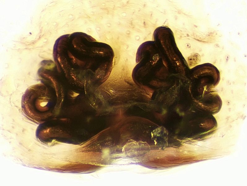 Datei:Marpissa-muscosa-vulva.jpg
