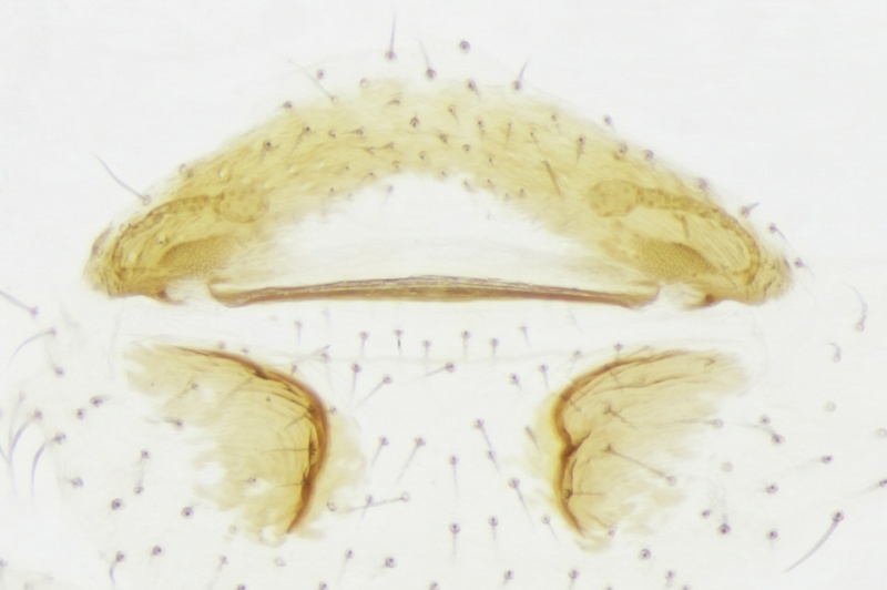 Datei:Scytodes sp9 Vulva Rehfeldt.jpg