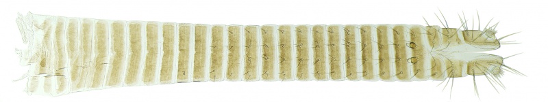 Datei:Leiobunum gracile Female Ovipositor.jpg