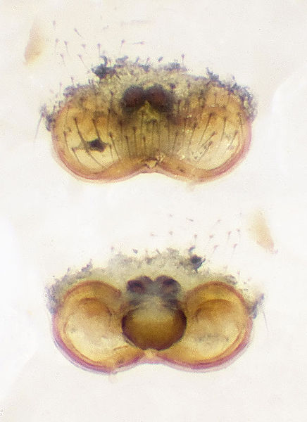 Datei:Erigone-atra Ettersberg 09-05 03-Epig-Vulva.jpg