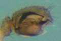 Pedipalpus (ventral)