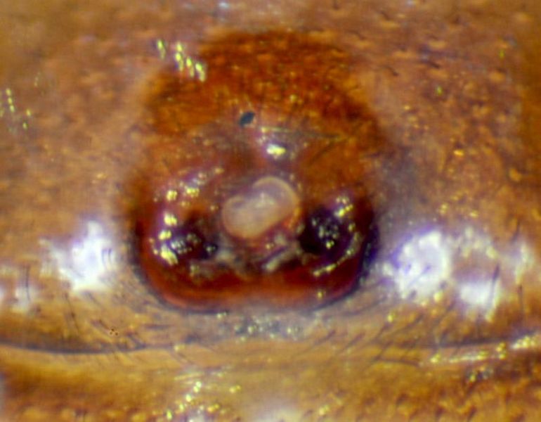 Datei:Episinus angulatus epigyne-800.jpg