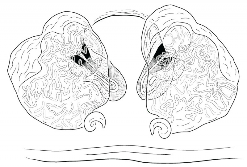 Datei:ThomisusOnustusEpigyneDorsalDrawing.jpg
