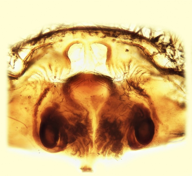 Datei:Lycosoides flavomaculata female Vulva 20161002125935-aec969a4-me.jpg