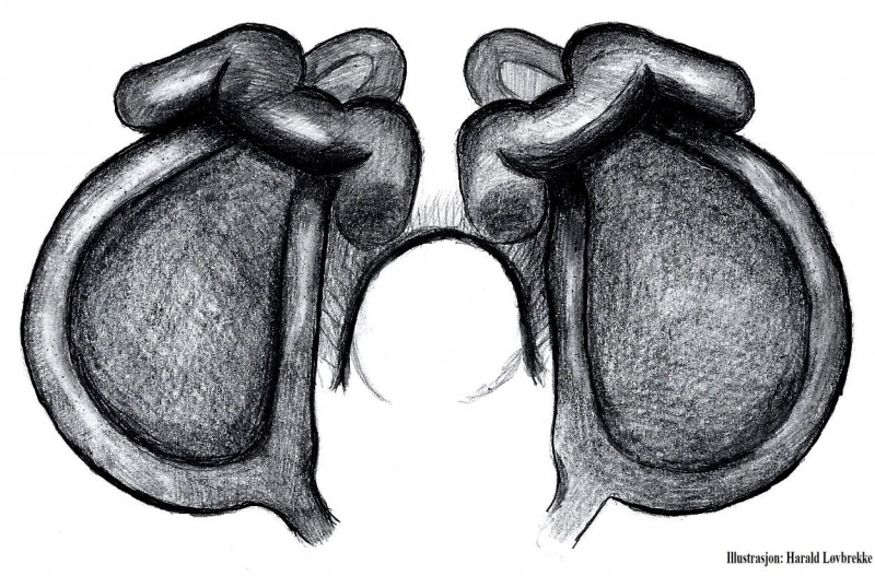Datei:Cheiracanthium erraticum vulva ventr HLovbrekke.jpg