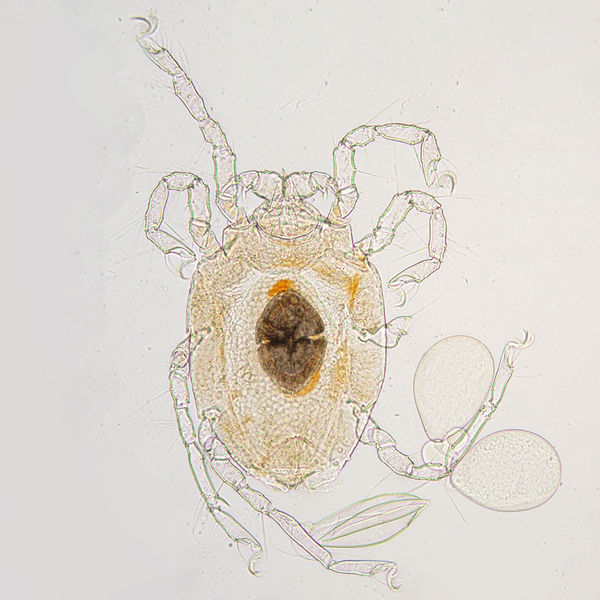 Datei:Limnohalacarus sp A5406 O2540.jpg